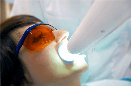 Understanding the Causes of Teeth Sensitivity Chelmsford