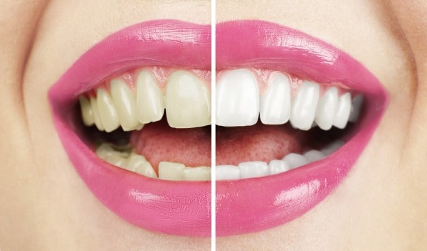 What Early Signs of Oral Cancer Should You Never Ignore Chelmsford?