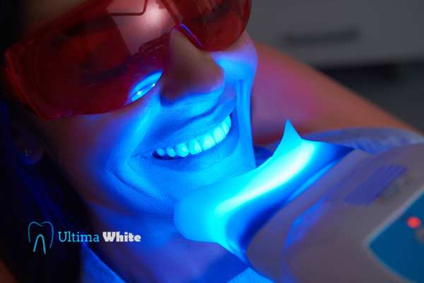 Professional Teeth Whitening Options Chelmsford