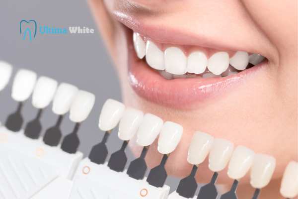How to Maximise the Results of Your Laser Teeth Whitening Treatment Chelmsford