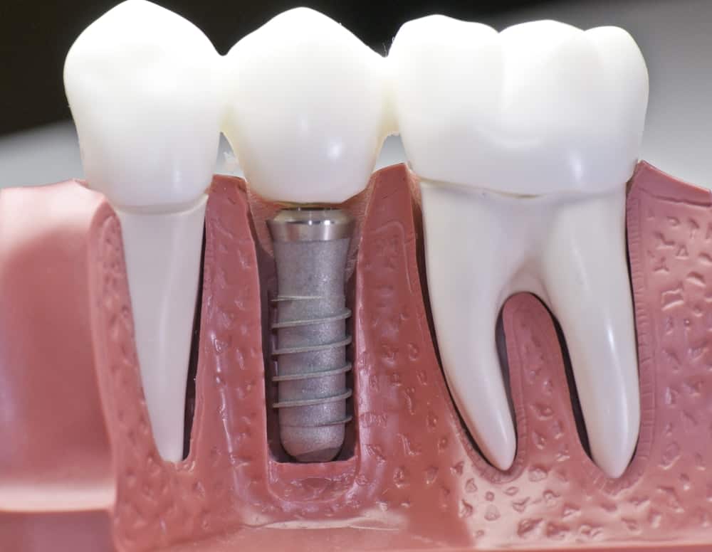 Common Misconceptions About Modern Dental Treatments Chelmsford