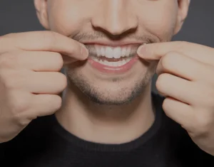 Overview of Home Teeth Whitening Kits Chelmsford