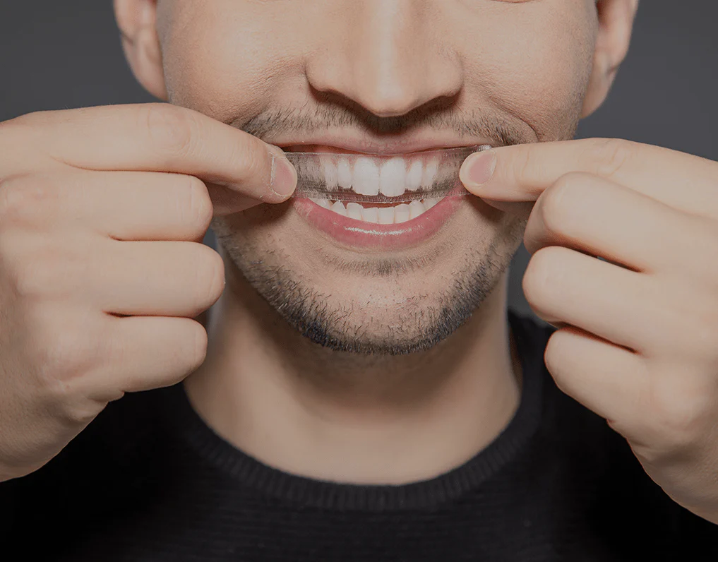 How Are Invisible Aligners Changing Orthodontic Treatments Chelmsford?