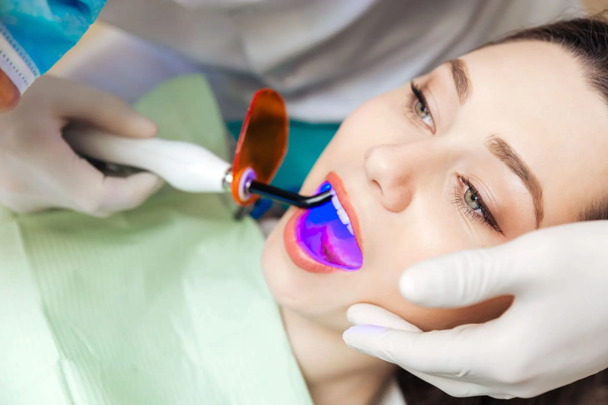 Common Risks of Whitening Without Expert Dental Guidance Chelmsford