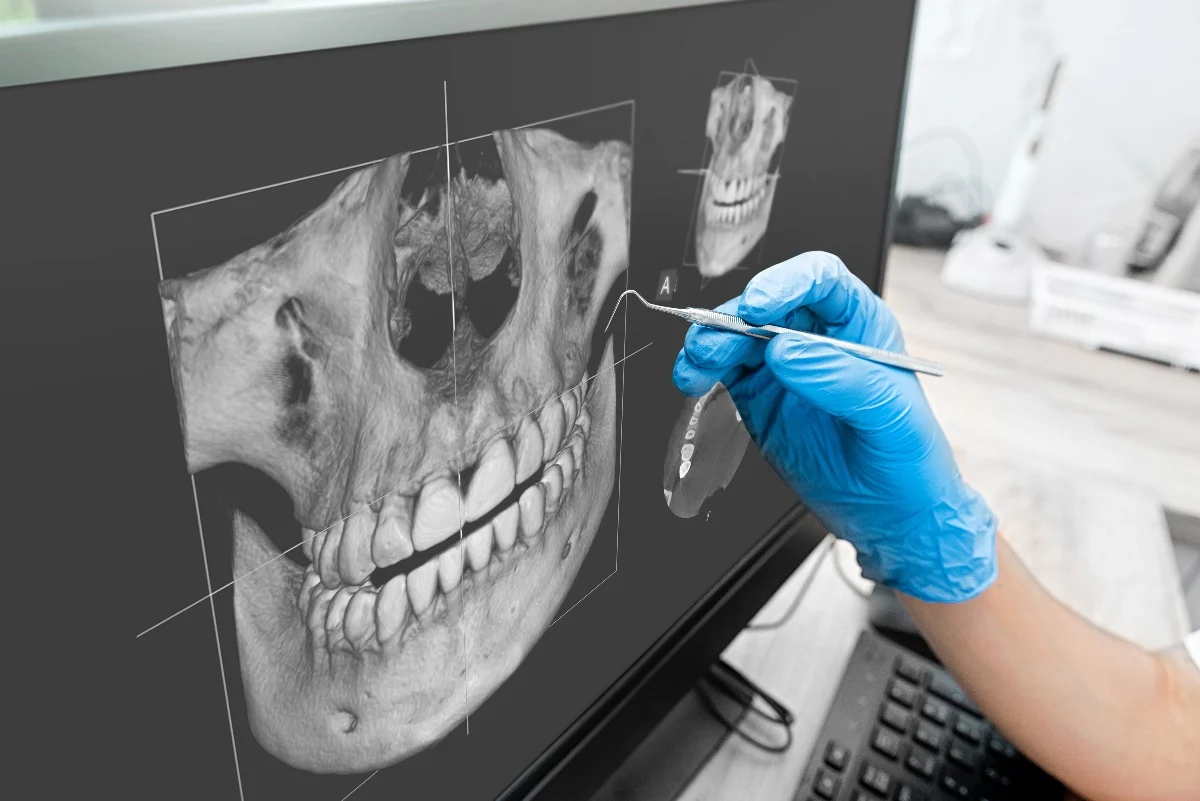 Key Benefits of 3D Printing for Patients and Dentists Chelmsford