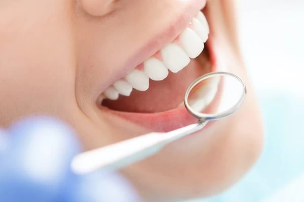 How to Maintain Your Whiter Smile After Treatment Chelmsford