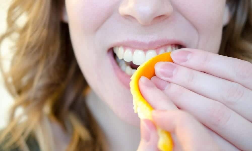 Signs Your Teeth Are Being Damaged by Acid Chelmsford