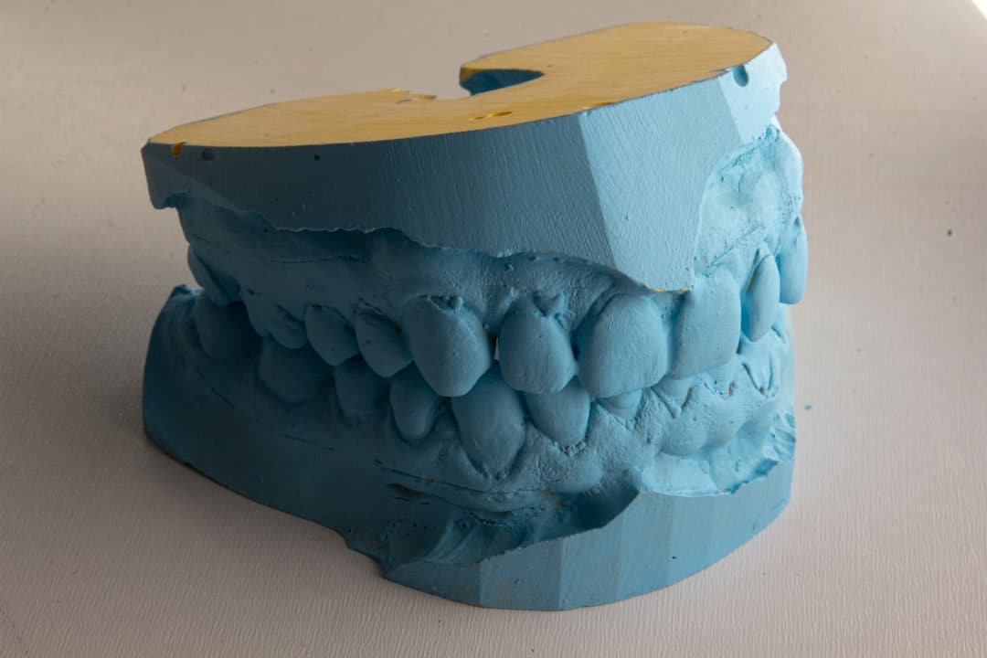 How Do Dental Implants Improve Jawbone Health and Oral Function Chelmsford?