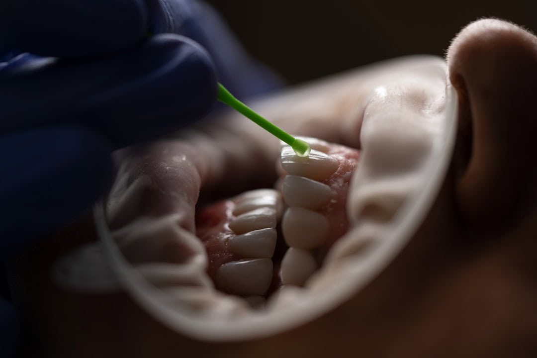 How Saliva Protects Your Teeth and Gums Chelmsford