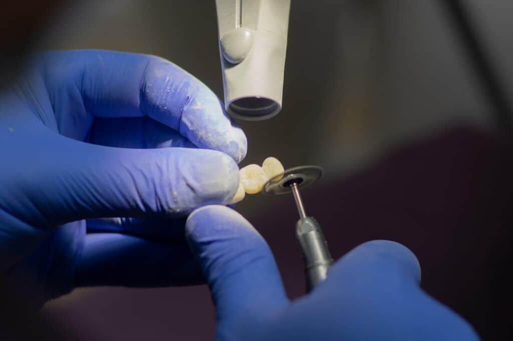 Customised Dental Solutions: Crowns, Aligners, and Implants Chelmsford