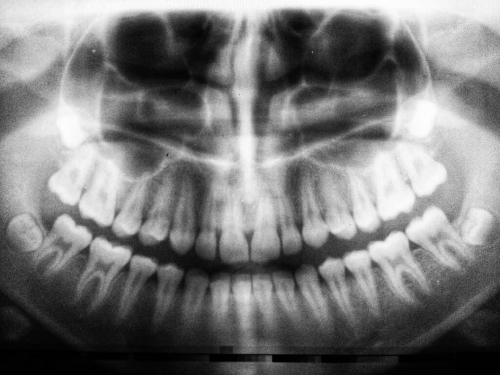 The Future of 3D Printing in Oral Healthcare Chelmsford