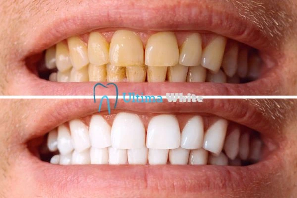 Stained Teeth and Persistent Bad Breath Chelmsford