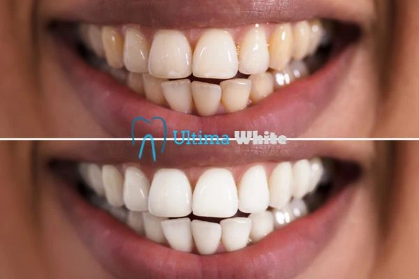 Long lasting results from Ultima White Chelmsford